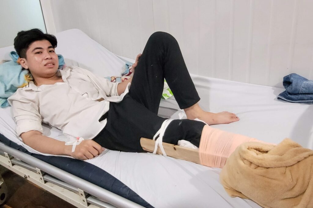 Nguyen Trong Phuc is treated with a broken leg at An Phu Hospital in Binh Duong Province, after jumping from the third floor of a karaoke parlor where he worked to escape a fire, September 7, 2022. Credit: VnExpress/Dinh Van.